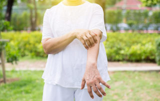 vista-simi-valley-senior-psoriasis-scratching-arm-outdoors